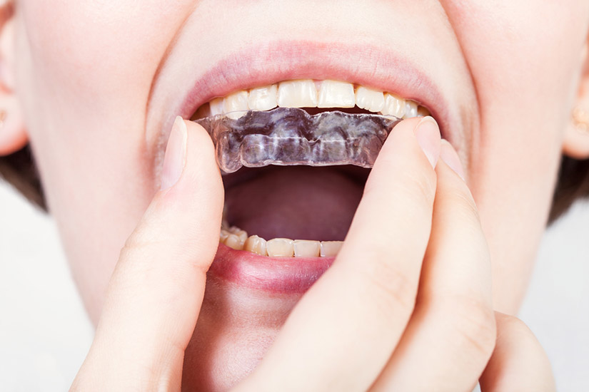 orthodontics
