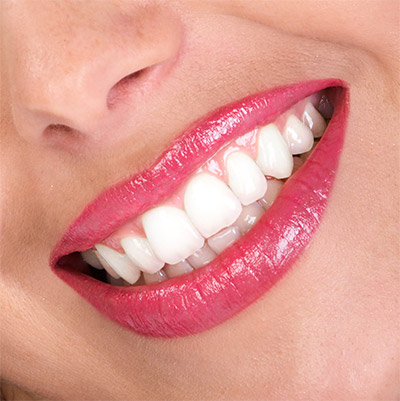 biting hard candy